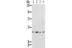 Western Blotting (WB) image for anti-Sjogren Syndrome Antigen B (SSB) antibody (ABIN2433932) (SSB antibody)