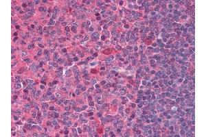 Human Tonsil: Formalin-Fixed, Paraffin-Embedded (FFPE) (DNASE1 antibody  (AA 1-252))