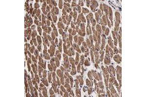 Immunohistochemical staining of human heart muscle with PSMA3 polyclonal antibody  shows moderate cytoplasmic positivity in myocytes. (PSMA3 antibody)