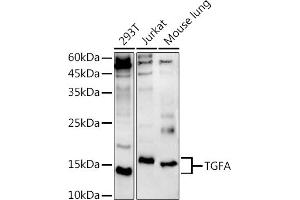 Western blot analysis of extracts of various cell lines, using TGFA antibody (ABIN3020947, ABIN3020948, ABIN3020949, ABIN1513602 and ABIN6213813) at 1:500 dilution. (TGFA antibody  (AA 24-98))