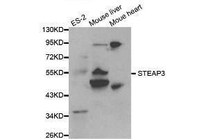 Western blot analysis of extracts of various cell lines, using STEAP3 antibody. (STEAP3 antibody)