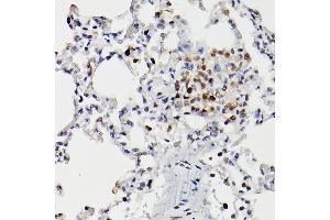 Immunohistochemistry of paraffin-embedded rat lung using HD Rabbit pAb (ABIN3022053, ABIN3022054, ABIN3022055 and ABIN6218586) at dilution of 1:25 (40x lens). (HDAC9 antibody  (AA 1-100))