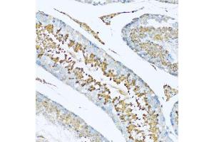 Immunohistochemistry of paraffin-embedded rat testis using HPX antibody. (Hemopexin antibody  (AA 24-245))