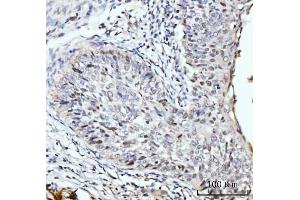 IHC analysis of SBNO1 using anti-SBNO1 antibody (ABIN7601710).