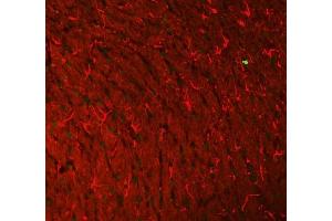 IF analysis of Histone H3 and GFAP using anti-Histone H3 antibody  and anti-GFAP antibody (ABIN7602675). (GFAP antibody  (AA 93-432))
