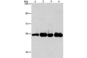 Western Blot analysis of Human bladder carcinoma tissue and A172 cell, Human fetal brain tissue and hela cell using PDE4D Polyclonal Antibody at dilution of 1:500 (PDE4D antibody)