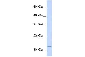 WB Suggested Anti-CRABP2 Antibody Titration:  0. (CRABP2 antibody  (Middle Region))