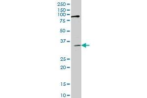 IBRDC1 monoclonal antibody (M01), clone 4B1 Western Blot analysis of IBRDC1 expression in HepG2 . (RNF217 antibody  (AA 2-100))