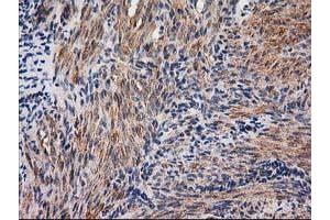 Immunohistochemical staining of paraffin-embedded Human endometrium tissue using anti-NNMT mouse monoclonal antibody. (NNMT antibody)
