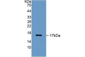 Detection of Recombinant C7, Rat using Polyclonal Antibody to Complement Component 7 (C7) (C7 antibody  (AA 1-144))