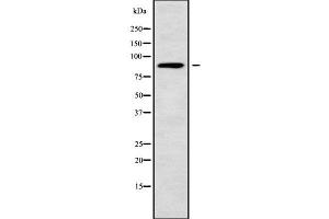 Western blot analysis NUP88 using COLO205 whole cell lysates (NUP88 antibody  (Internal Region))