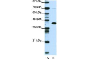 Western Blotting (WB) image for anti-Zinc Finger and BTB Domain Containing 25 (ZBTB25) antibody (ABIN2460742)