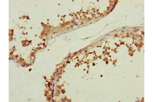 Immunohistochemistry of paraffin-embedded human testis tissue using ABIN7147357 at dilution of 1:100 (CETN3 antibody  (AA 1-167))