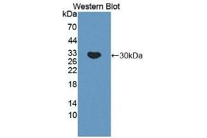 Detection of Recombinant C4BPa, Mouse using Polyclonal Antibody to C4 Binding Protein Alpha (C4BPa) (C4BPA antibody  (AA 57-306))