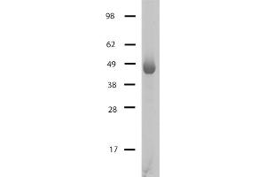 HDAC4 protein gel. (HDAC4 Protein (AA 645-1057, Catalytic Domain))