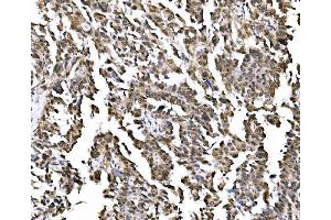 IHC analysis of NOLA1/GAR1 using anti-NOLA1/GAR1 antibody (ABIN7602076). (GAR1 antibody  (AA 58-165))