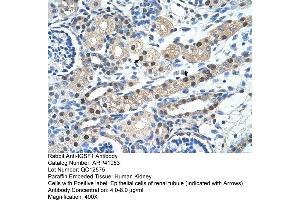 Rabbit Anti-IGSF1 Antibody  Paraffin Embedded Tissue: Human Kidney Cellular Data: Epithelial cells of renal tubule Antibody Concentration: 4. (IGSF1 antibody  (N-Term))