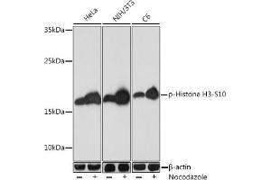 Western blot analysis of extracts of various cell lines, using Phospho-Histone H3-S10 Rabbit pAb (ABIN7267687) at 1:1000 dilution. (Histone 3 antibody  (H3S10p))