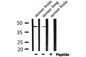 Western blot analysis of extracts from mouse brain, mouse lung, using CEACAM16 Antibody. (CEACAM16 antibody  (Internal Region))