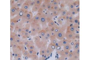 Used in DAB staining on fromalin fixed paraffin- embedded liver tissue (DAAM1 antibody  (AA 1-250))
