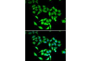 Immunofluorescence analysis of U2OS cells using CCT3 antibody. (CCT3 antibody)