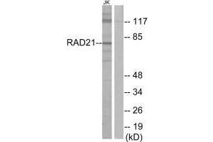 Western blot analysis of extracts from Jurkat cells, using RAD21 antibody. (RAD21 antibody)