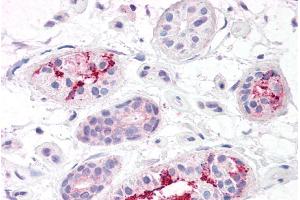 ABIN2613396 (5µg/ml) staining of paraffin embedded Human Skin. (BOD1L1 antibody  (AA 2802-2815))