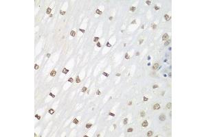 Immunohistochemistry of paraffin-embedded human esophagus using FOSL2 antibody (ABIN3016548, ABIN3016549, ABIN3016550 and ABIN6219779) at dilution of 1:100 (40x lens). (FOSL2 antibody  (AA 187-326))