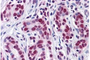 Immunohistochemistry (Formalin-fixed Paraffin-embedded Sections) (IHC (fp)) image for anti-ELAV (Embryonic Lethal, Abnormal Vision, Drosophila)-Like 1 (Hu Antigen R) (ELAVL1) (AA 1-101) antibody (ABIN574241)