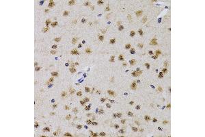 Immunohistochemistry of paraffin-embedded mouse brain using CDK7 antibody (ABIN3022404, ABIN3022405, ABIN3022406 and ABIN6218792) at dilution of 1:200 (40x lens). (CDK7 antibody  (AA 1-346))