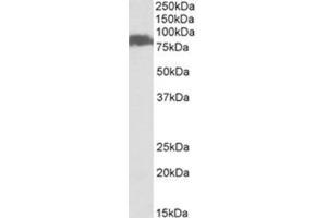 Western Blotting (WB) image for anti-Solute Carrier Family 26, Member 6 (SLC26A6) (Internal Region) antibody (ABIN1449464) (SLC26A6 antibody  (Internal Region))