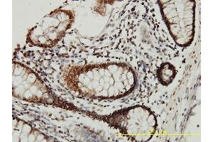 Immunoperoxidase of monoclonal antibody to CSTB on formalin-fixed paraffin-embedded human colon tissue. (CSTB antibody  (AA 1-98))
