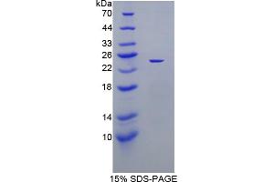 Image no. 1 for Xanthine Dehydrogenase (XDH) (AA 231-416) protein (His tag) (ABIN4989398) (XDH Protein (AA 231-416) (His tag))