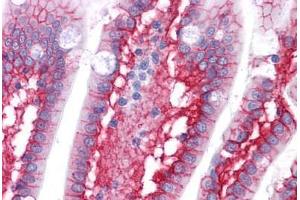 Human Small Intestine: Formalin-Fixed, Paraffin-Embedded (FFPE)