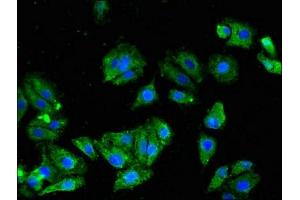Immunofluorescence (IF) image for anti-Potassium Voltage-Gated Channel, Shaw-Related Subfamily, Member 1 (KCNC1) (AA 1-190) antibody (ABIN7163965)