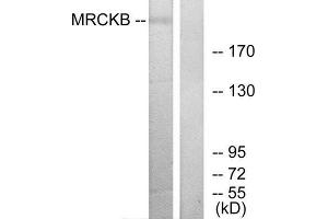 Western Blotting (WB) image for anti-CDC42 Binding Protein Kinase beta (DMPK-Like) (CDC42BPB) (C-Term) antibody (ABIN1850128)