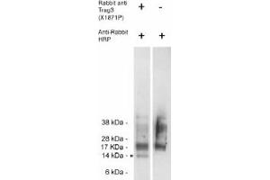 Image no. 1 for anti-CSAG Family, Member 2 (CSAG2) antibody (ABIN265186) (CSAG2 antibody)