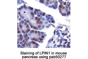 Image no. 1 for anti-Lipin 1 (LPIN1) (AA 300-400), (Internal Region) antibody (ABIN363586)