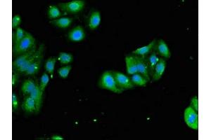 Immunofluorescent analysis of HepG2 cells using ABIN7142825 at dilution of 1:100 and Alexa Fluor 488-congugated AffiniPure Goat Anti-Rabbit IgG(H+L) (RPL4 antibody  (AA 12-91))