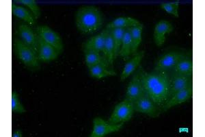 Immunofluorescence staining of HepG2 cells with ABIN7147234 at 1:50, counter-stained with DAPI. (CDK5RAP3 antibody  (Regulatory Subunit))