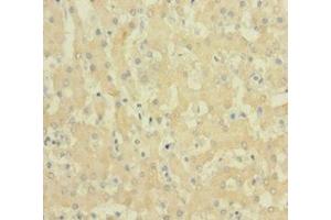 Immunohistochemistry of paraffin-embedded human liver tissue using ABIN7152719 at dilution of 1:100 (FTL antibody  (AA 2-175))