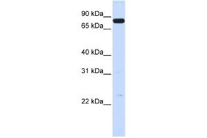 WB Suggested Anti-HGF Antibody Titration:  0. (HGF antibody  (N-Term))