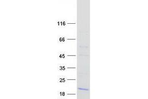 Western Blotting (WB) image for Trafficking Protein Particle Complex 2 (TRAPPC2) (Transcript Variant 2) protein (Myc-DYKDDDDK Tag) (ABIN2734118)