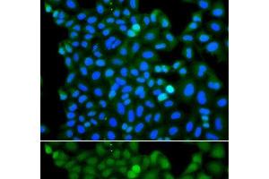 Immunofluorescence analysis of A549 cells using RNF125 Polyclonal Antibody (RNF125 antibody)