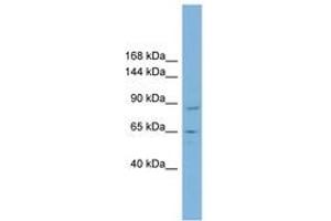 Image no. 1 for anti-TBC1 Domain Containing Kinase (TBCK) (AA 287-336) antibody (ABIN6742114) (TBCK antibody  (AA 287-336))