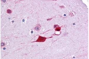 Human Brain, Cortex: Formalin-Fixed, Paraffin-Embedded (FFPE) (FABP4 antibody  (AA 71-120))