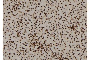 ABIN6276477 at 1/100 staining Mouse liver tissue by IHC-P. (PPP3CA antibody  (N-Term))