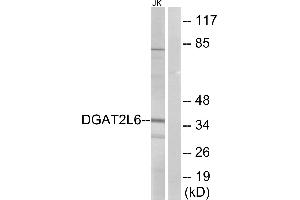 Western blot analysis of extracts from Jurkat cells, using DGAT2L6 antibody.