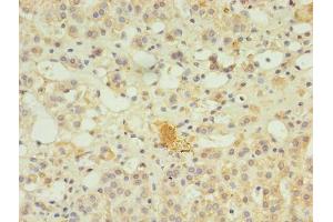 Immunohistochemistry of paraffin-embedded human adrenal gland tissue using ABIN7169349 at dilution of 1:100 (SERPINB8 antibody  (AA 60-242))