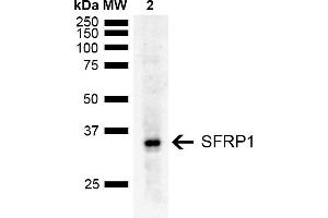 Western blot analysis of Rat Liver showing detection of ~35 kDa SFRP1 protein using Rabbit Anti-SFRP1 Polyclonal Antibody (ABIN5667734). (SFRP1 antibody  (AA 1-100) (FITC))